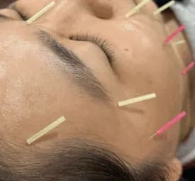 美颜针 / 减肥针