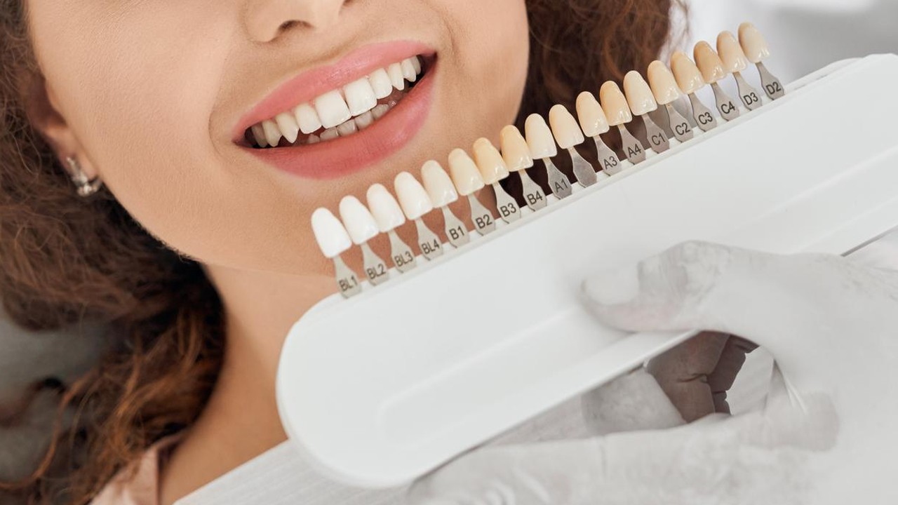 Teeth Whitening in JB: Your Complete Guide to a Brighter Smile in Johor Bahru (2026)