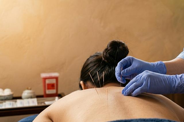5 Common Health Conditions TCM Acupuncture Can Help With, From Neck Pain to Menstrual Issues