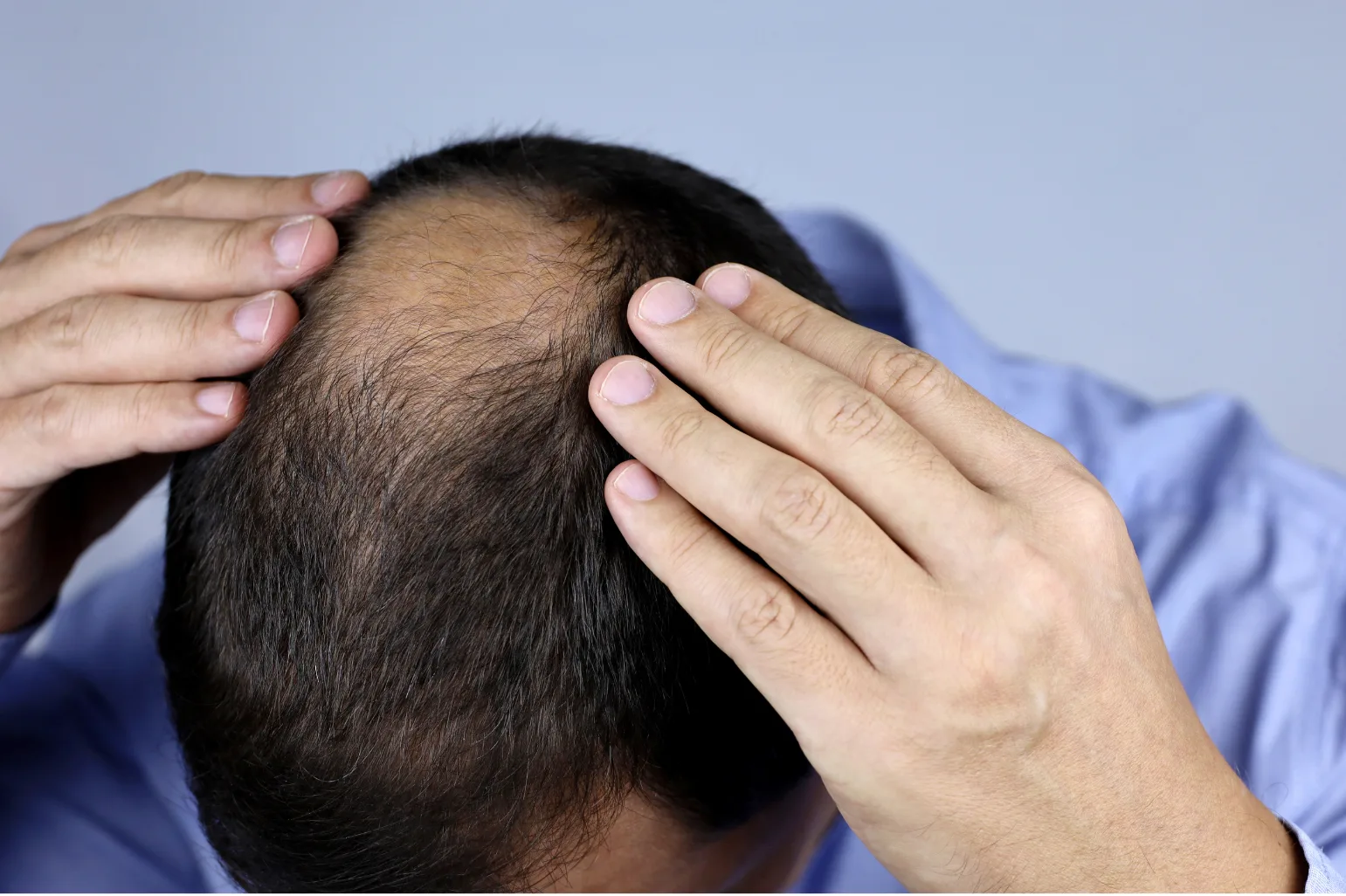 Hair density viewed from above