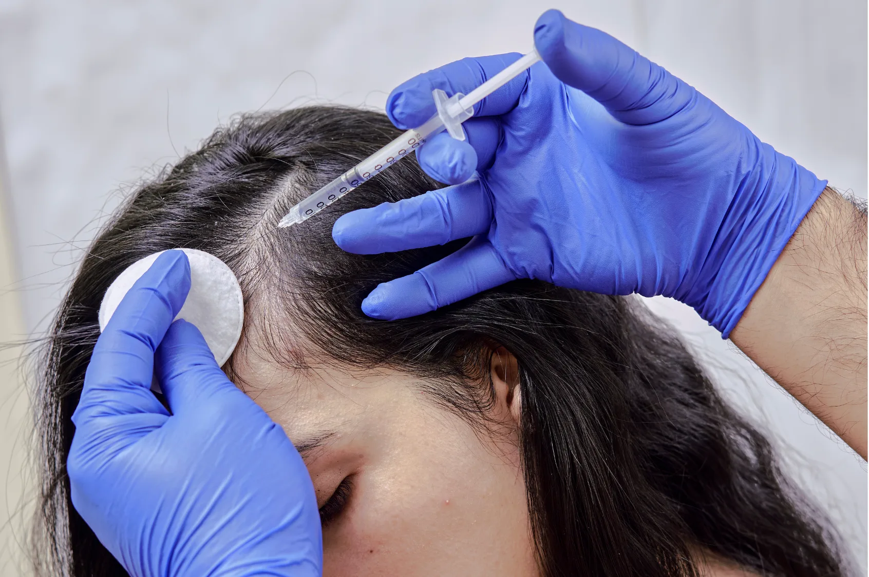 Personalised hair treatment planning