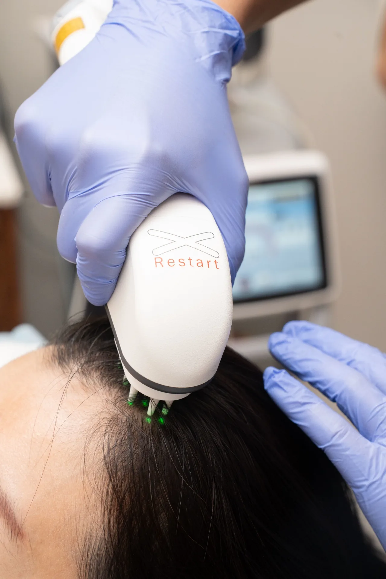 Device-led treatment in a modern clinic