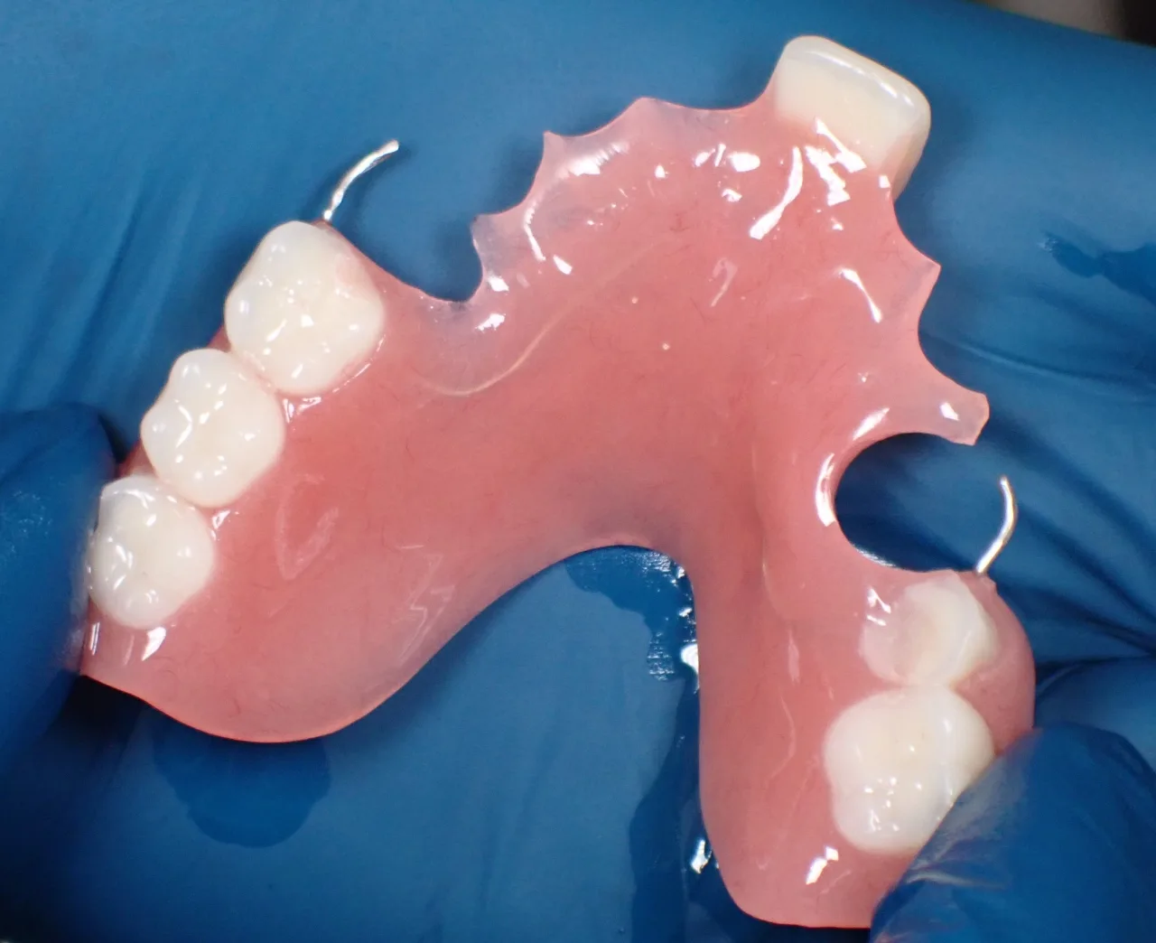 Dental consultation