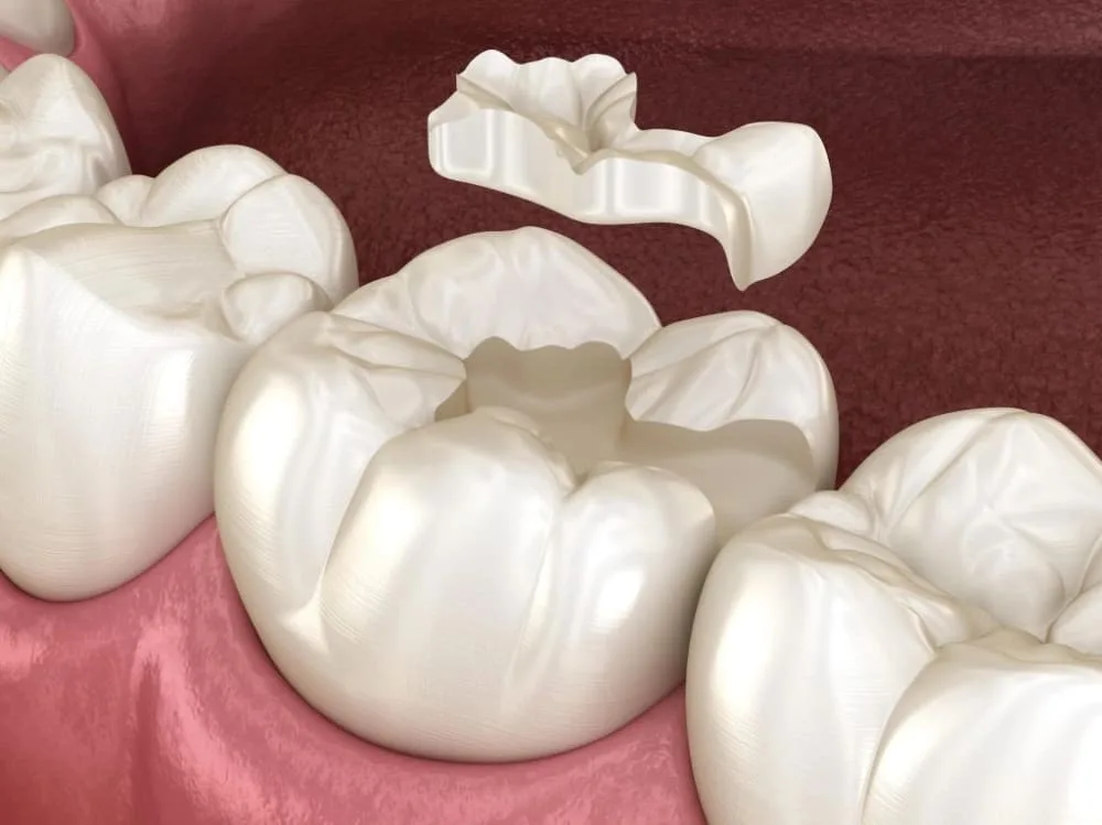 Dental consultation