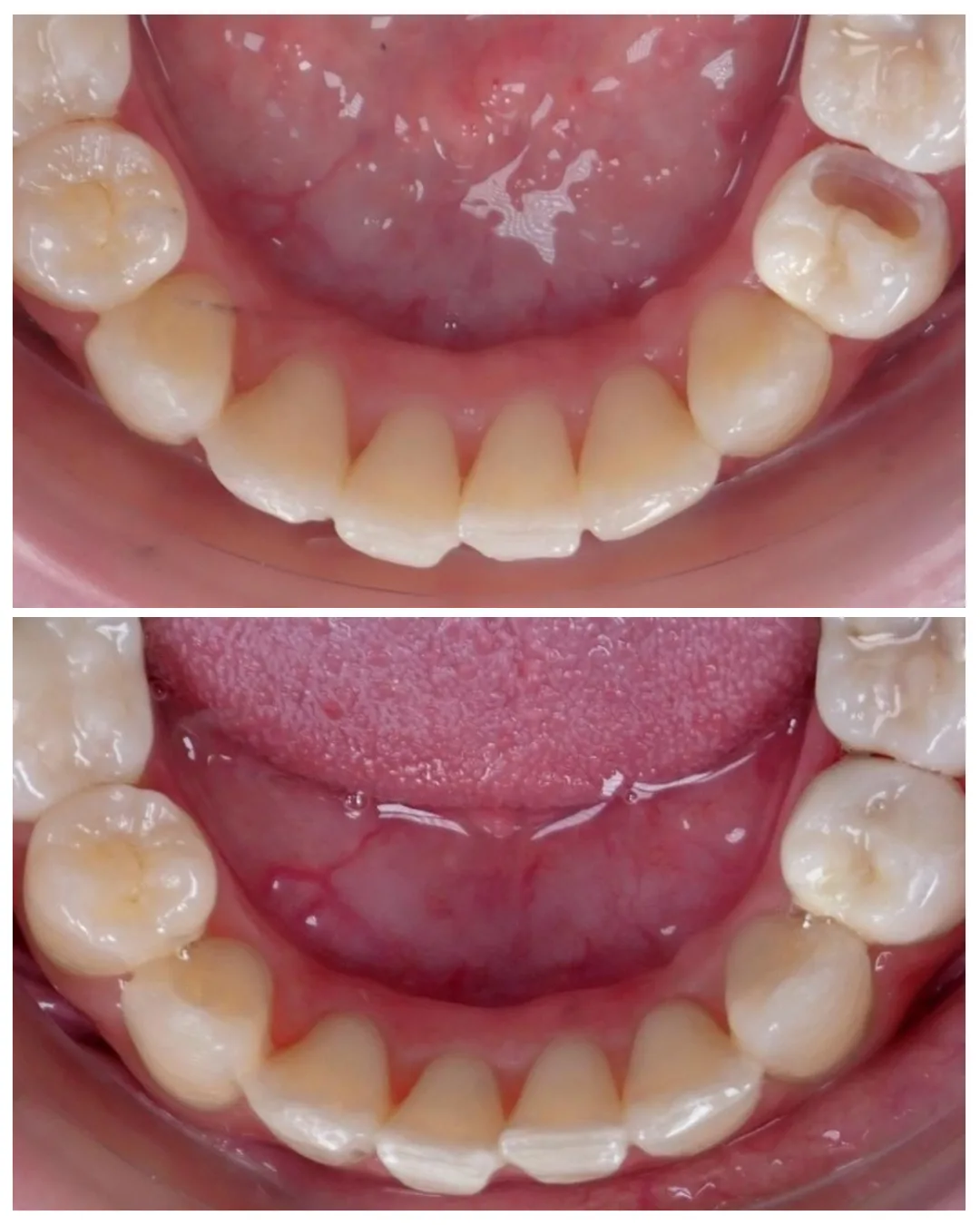 Implant treatment image