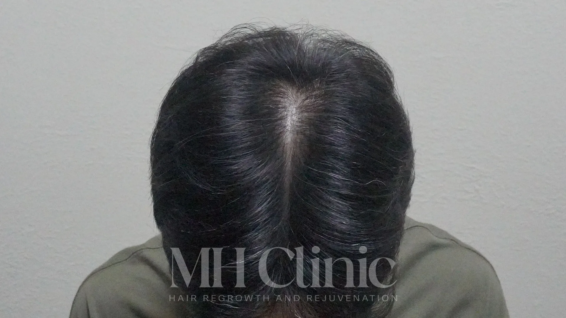 Result Row 1 Image 1