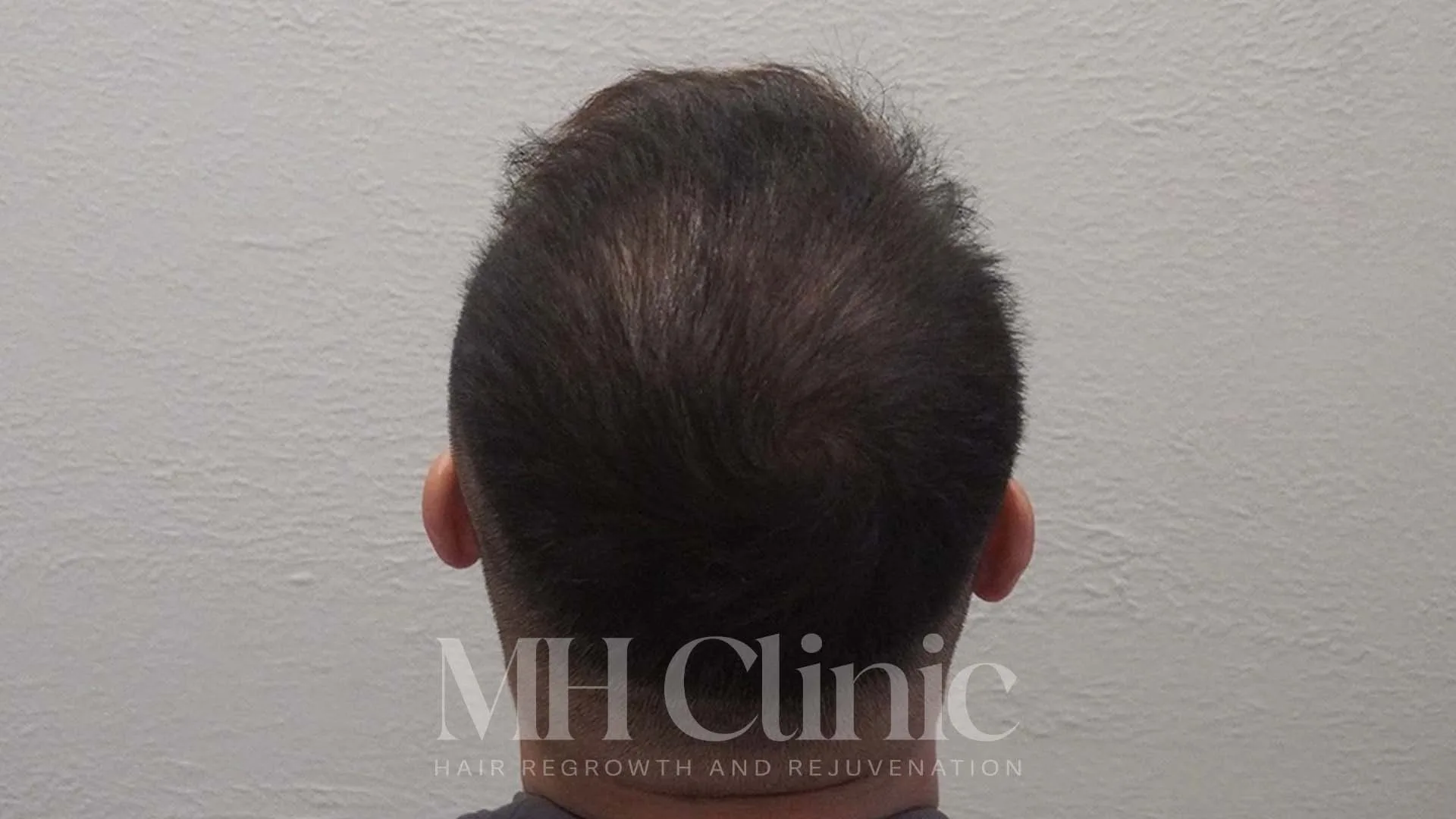 Before treatment image