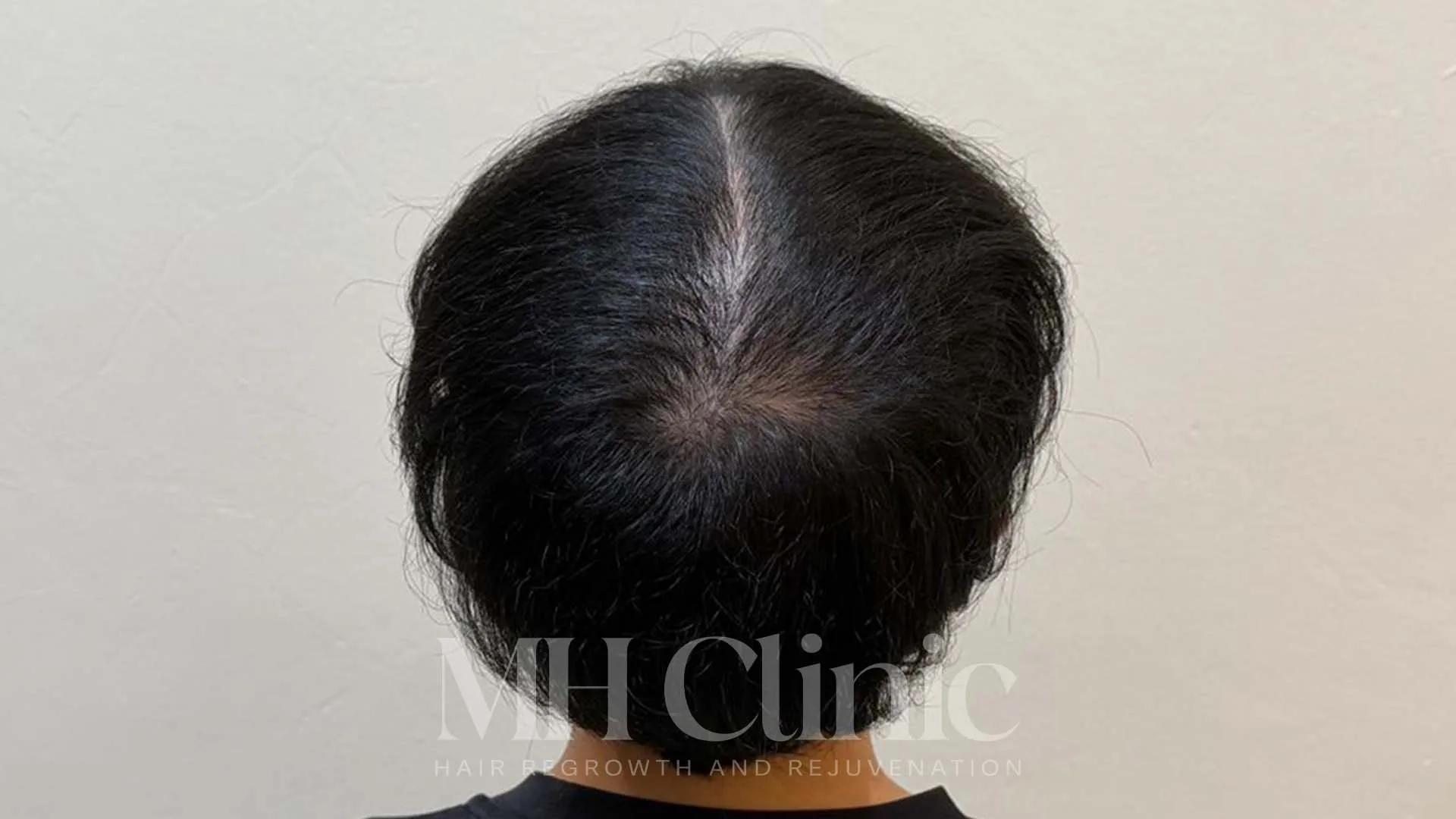Before treatment image