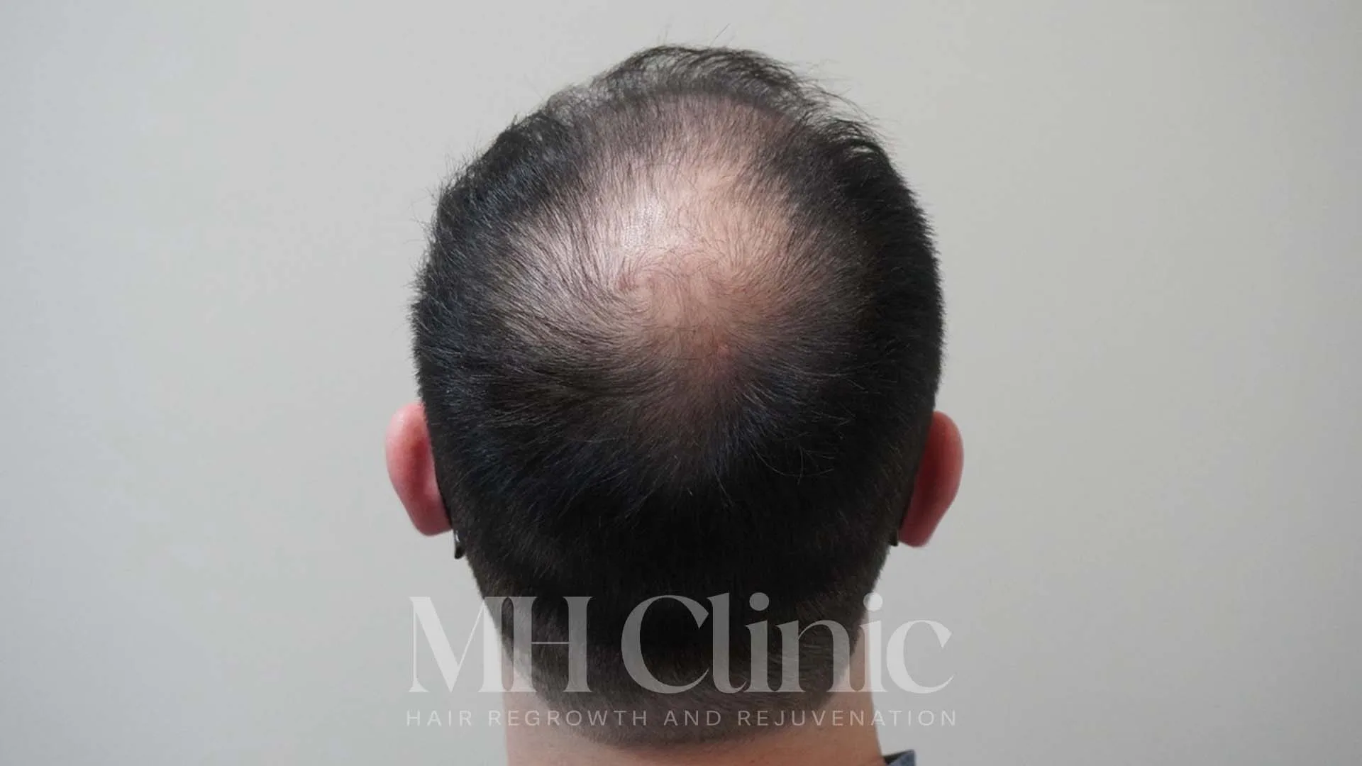 Before treatment result placeholder