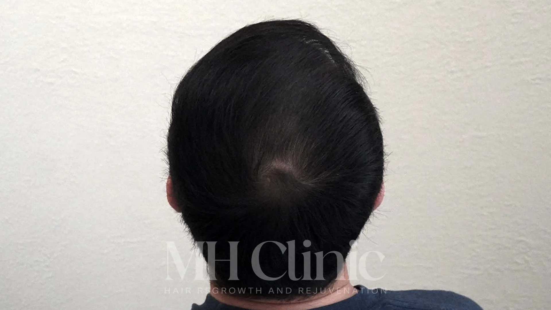 Result Row 2 Image 1