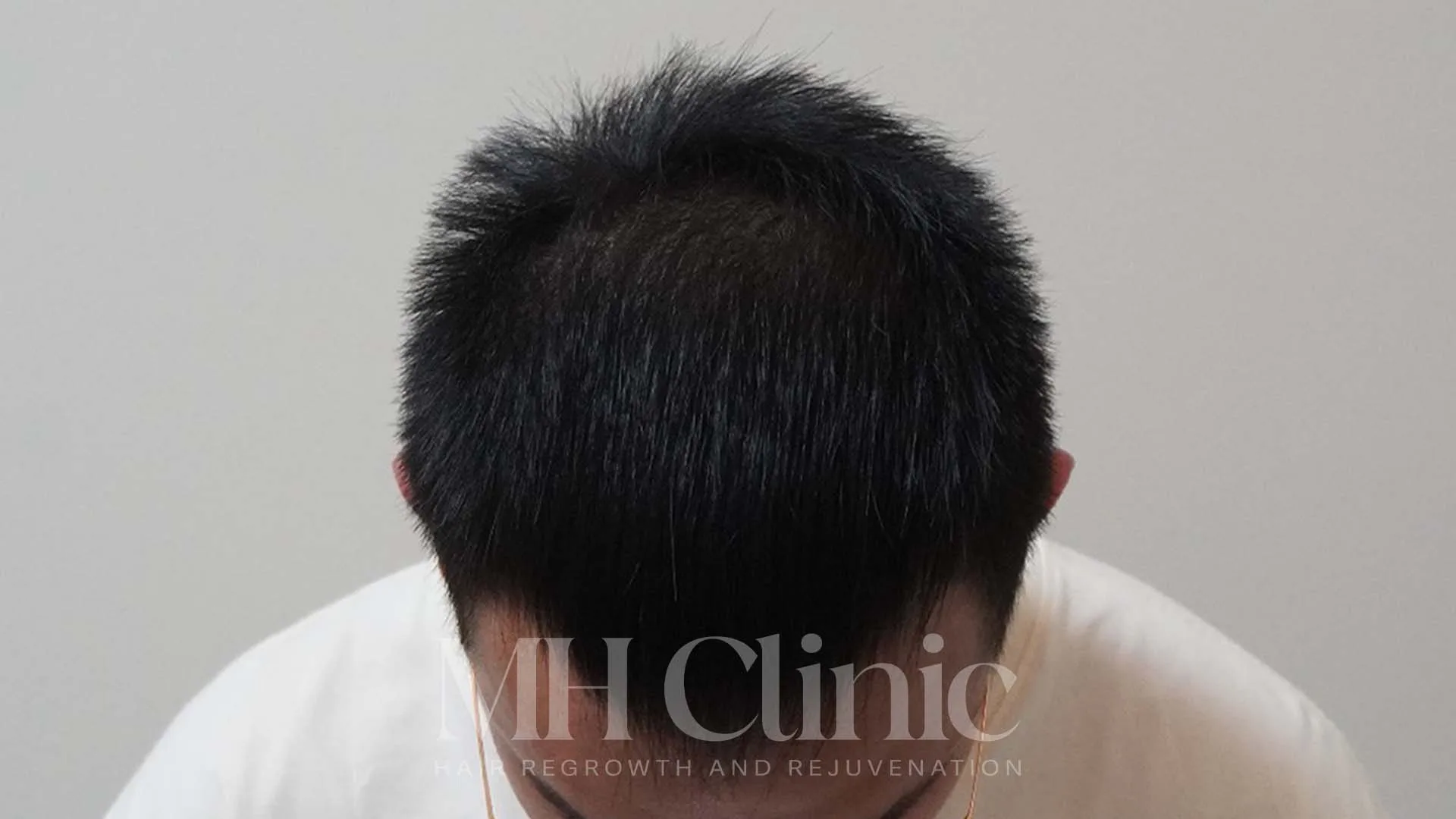 Result Row 2 Image 1