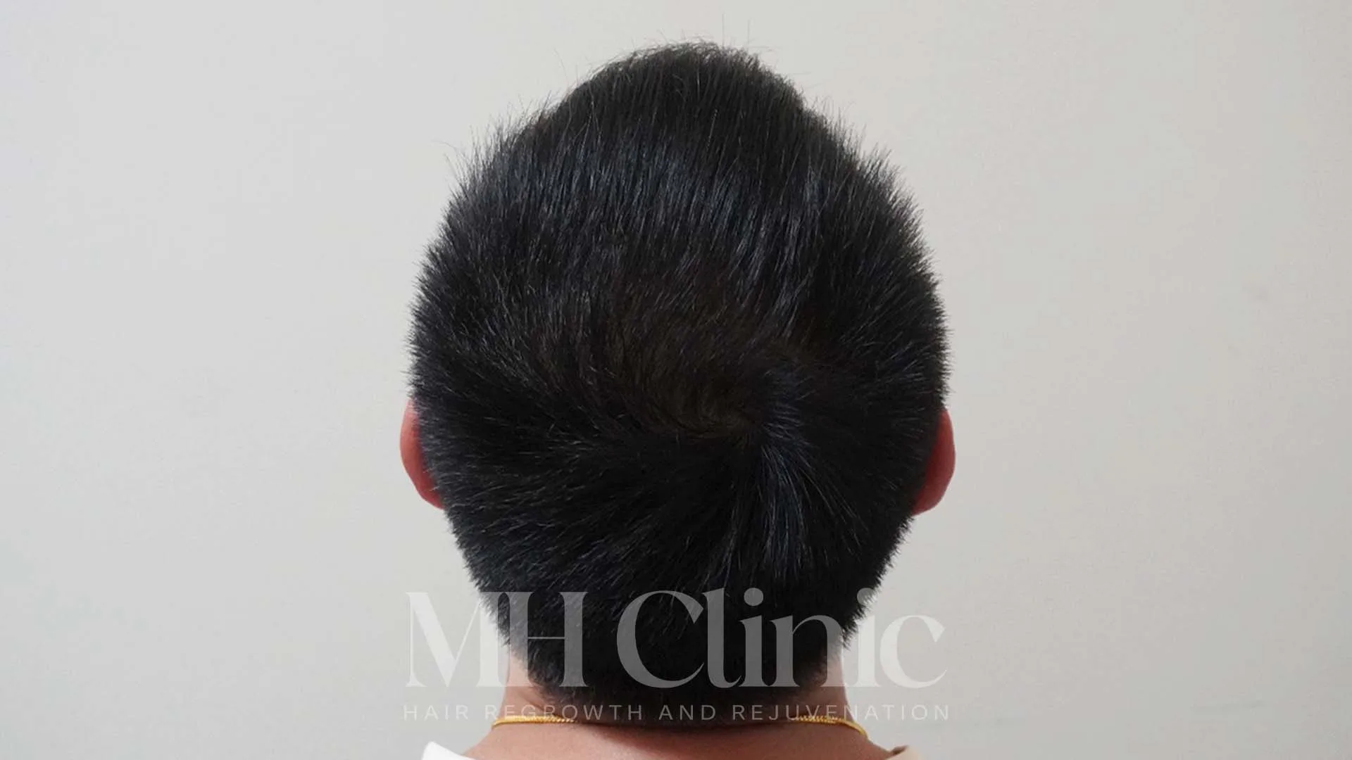 Result Row 2 Image 1