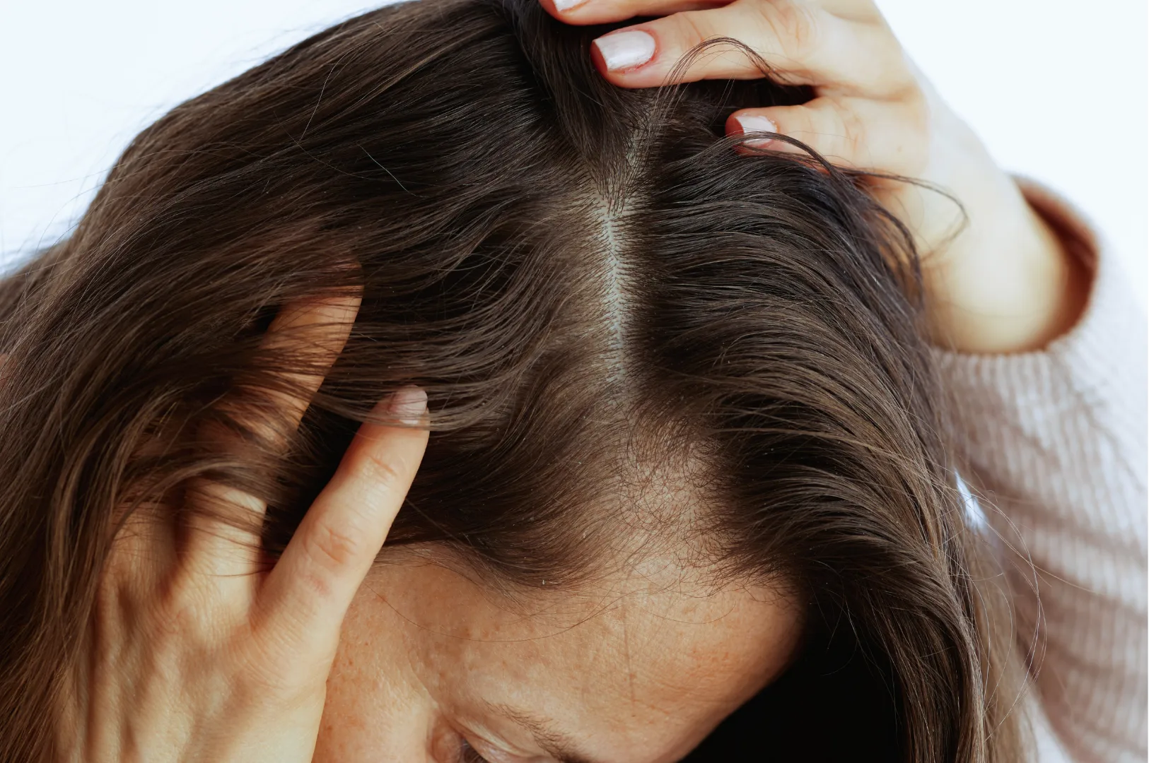 Hair loss for men