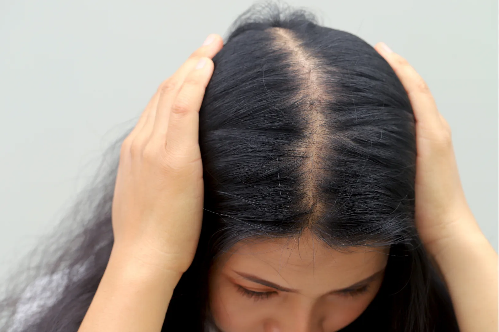 Hair loss for men