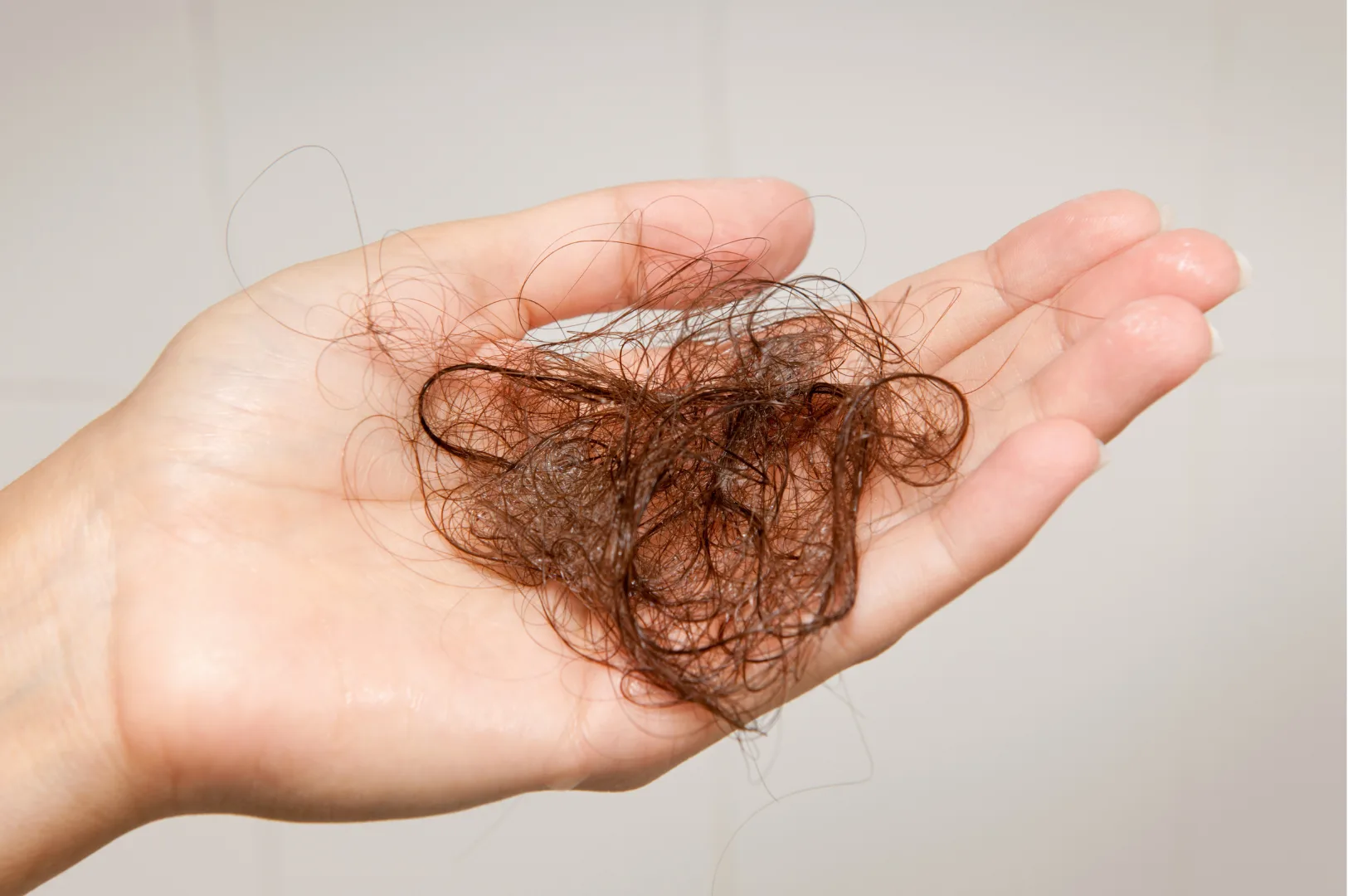 Hair loss for men