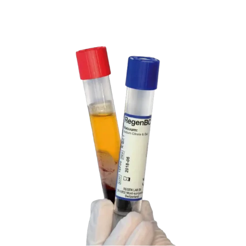 PRP Injection