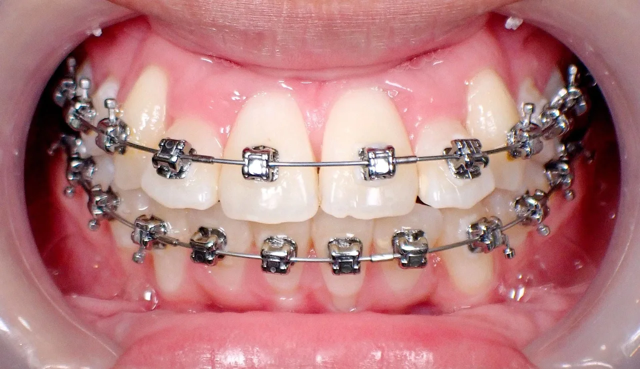 Dental service