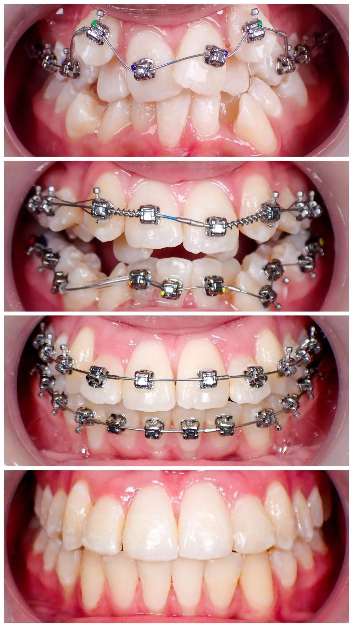 Implant treatment image