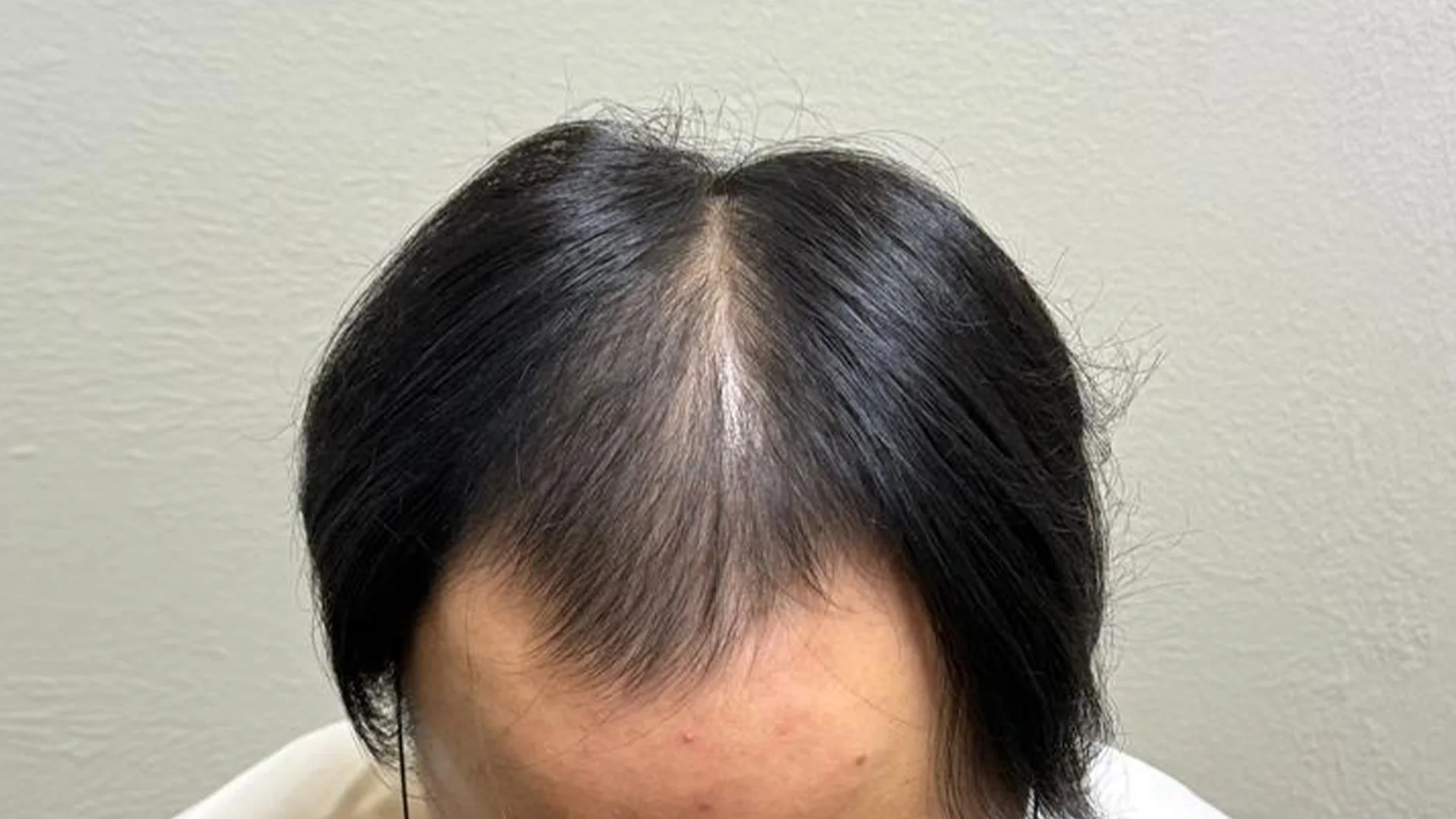 Before treatment image