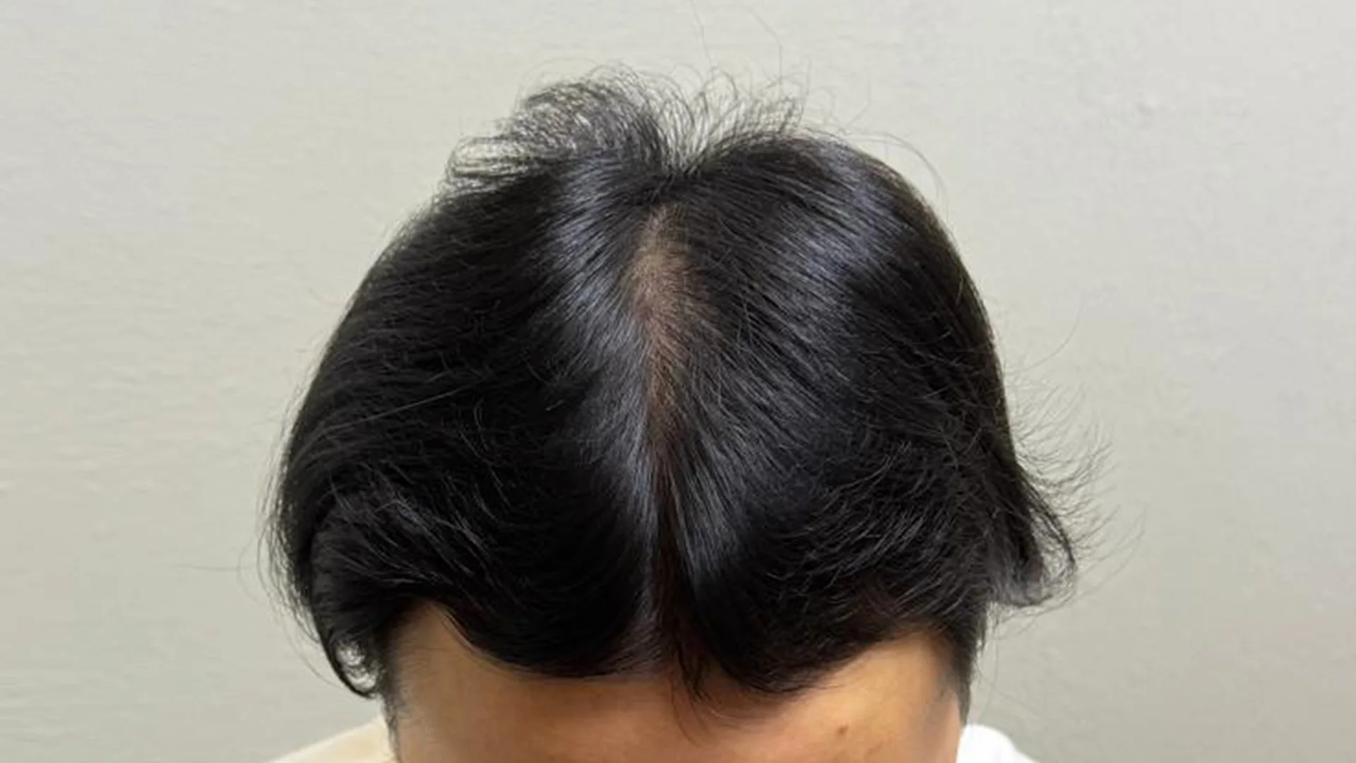 After treatment image